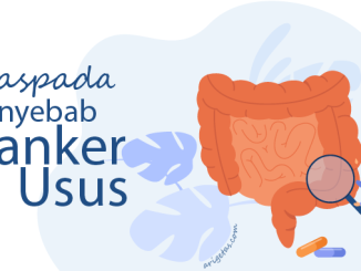 5 penyebab kanker usus yang perlu diwaspadai seperti faktor usia, pola hidup tidak sehat, berat badan, hingga mutasi genetik