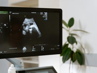 Perkembangan ultrasonografi untuk monitoring kesehatan bermula dari eksperimen gelombang bunyi hingga dapat diterapkan di dunia medis