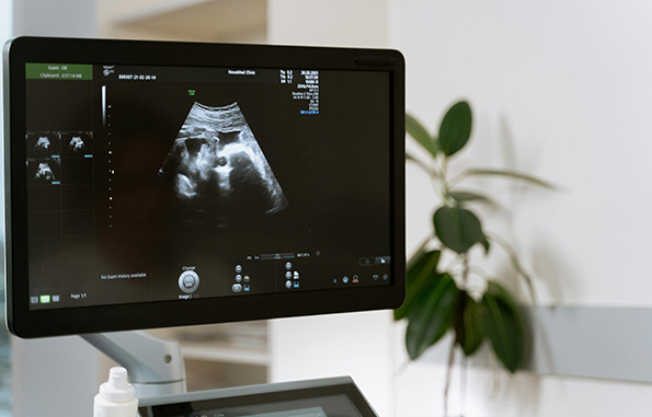 Perkembangan ultrasonografi untuk monitoring kesehatan bermula dari eksperimen gelombang bunyi hingga dapat diterapkan di dunia medis
